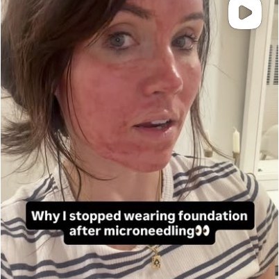 Aiken Medical Aesthetics on Instagram
